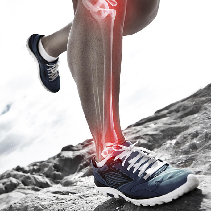 Running Injury Prevention: Taking the Right Steps